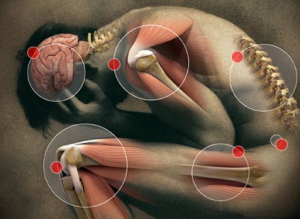 Fluoroquinolone Joint Pain